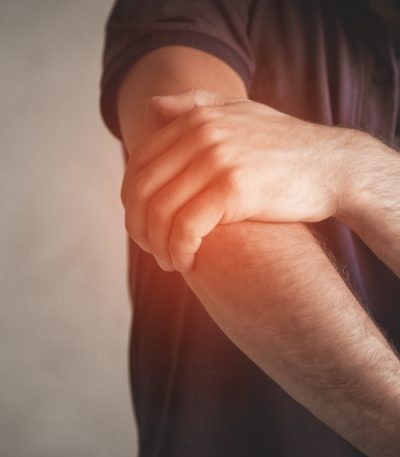 síntomas de Neuropatía